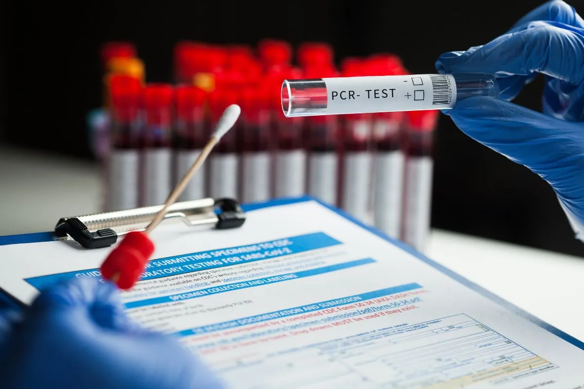 Evde PCR ve Antikor Testi Hizmeti, Fiyatları, Antalya